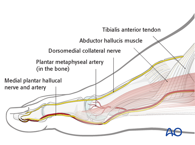 Medial approach to the 1st metatarsal