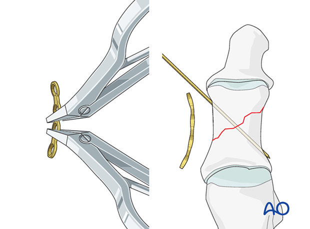 Contouring of plate