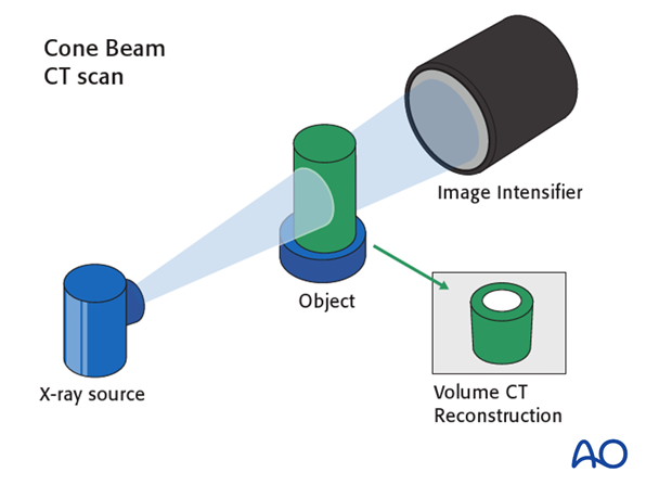 cone beam vs fan beam ct