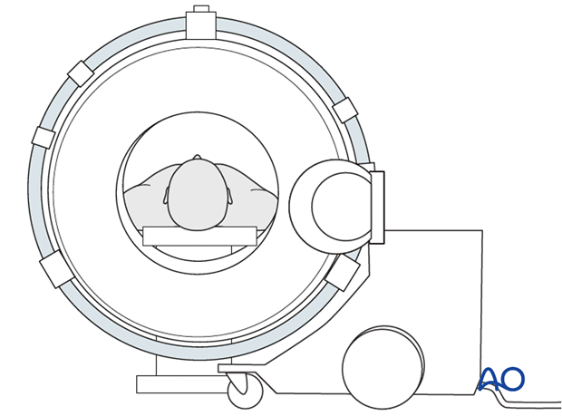 cone beam vs fan beam ct