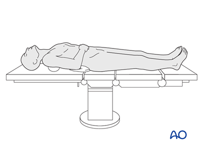 ORIF, arch bar and load-sharing plate for Symphysis and parasymphysis ...