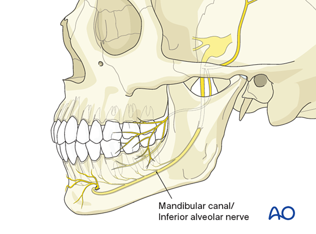 Mandibular nerve dental surgery