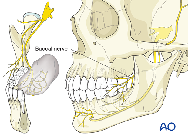 Mandibular Nerve (V3)