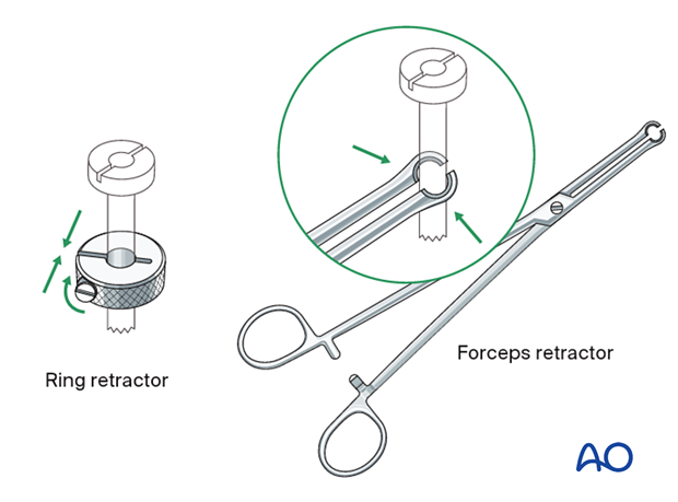 Ring and forceps retractor