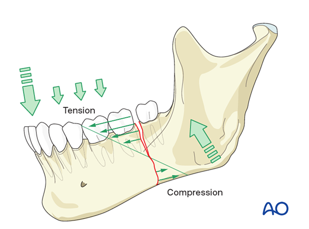 The mandible's superior border is the tension zone, and the inferior border is the compression zone while the mandible is in function.