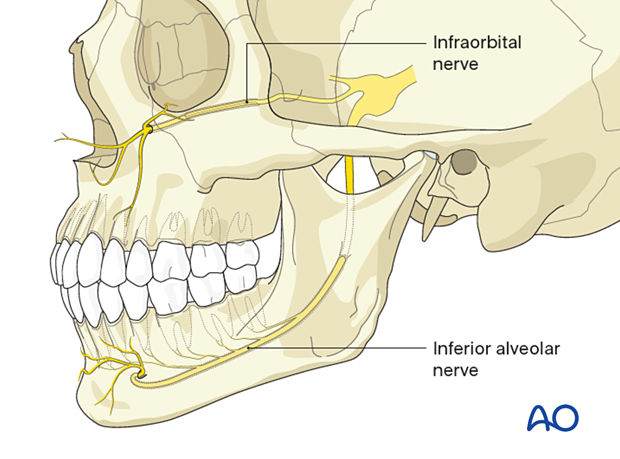 Mandibulomaxillary fixation: tooth roots, infraorbital nerve, and inferior alveolar nerve
