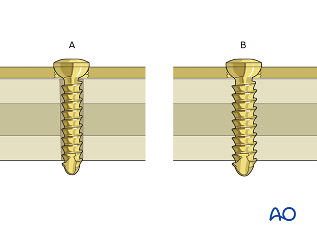 Emergency screws