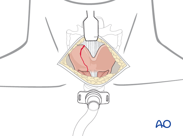 Airway considerations