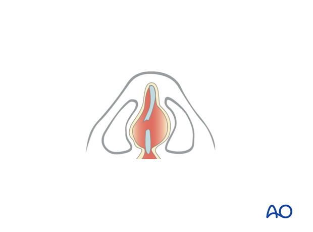 examination of patients with midfacial injuries