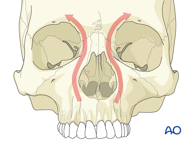 Diagnosis of NOE fractures