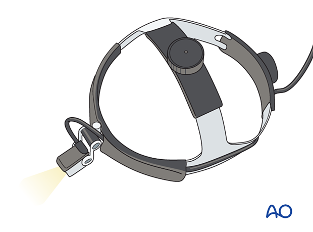 Headlight for orbital surgery.