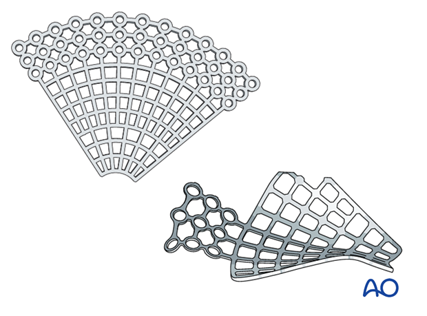 Non prebent and preformed orbital plates used in orbital reconstruction.