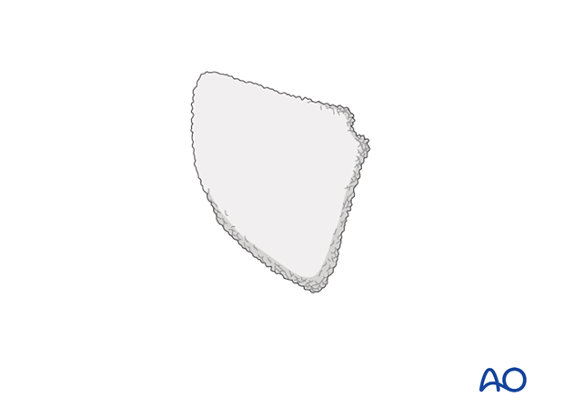 Porous polyethylene sheets for orbital reconstruction.