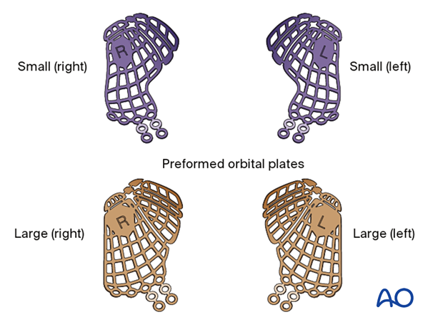 Preformed anatomic orbital implants.