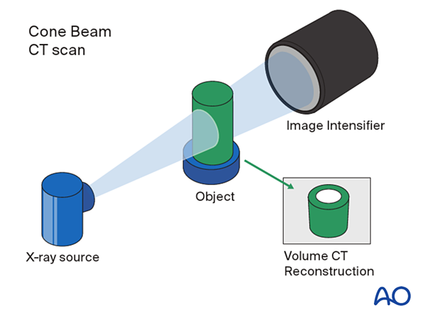 Fan beam computed tomography.