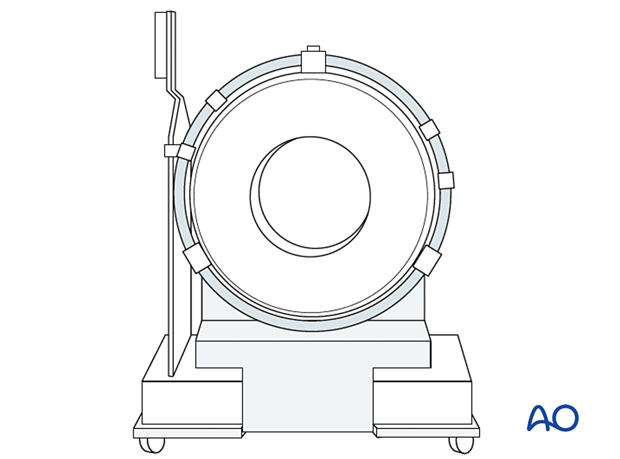 Computer assisted surgery – Data acquisition