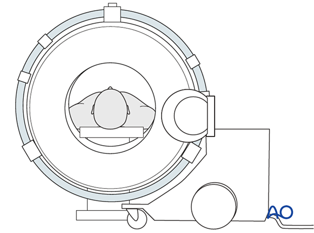 Portable fan beam scanners small gantry size limiting access to the lower facial skeleton.