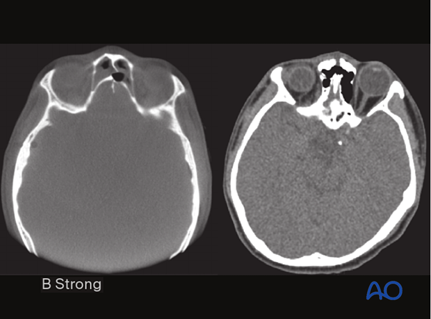 Cone beam and fan beam CT scan.