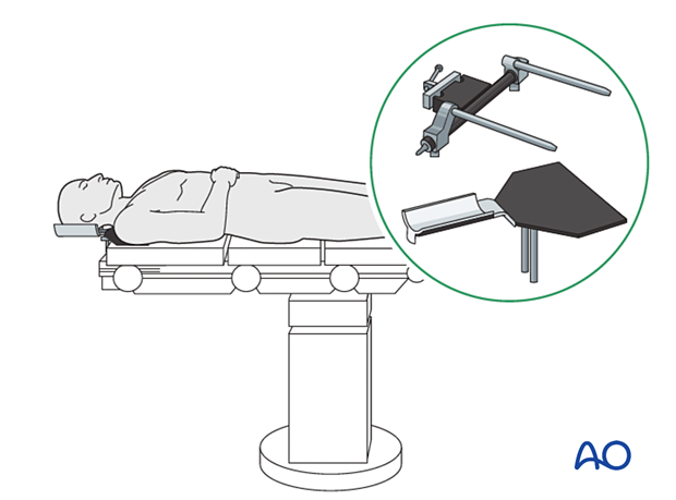 CAS operating room table set up.