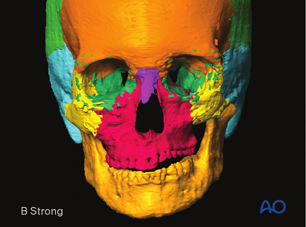 Computer assisted surgery – segmentation