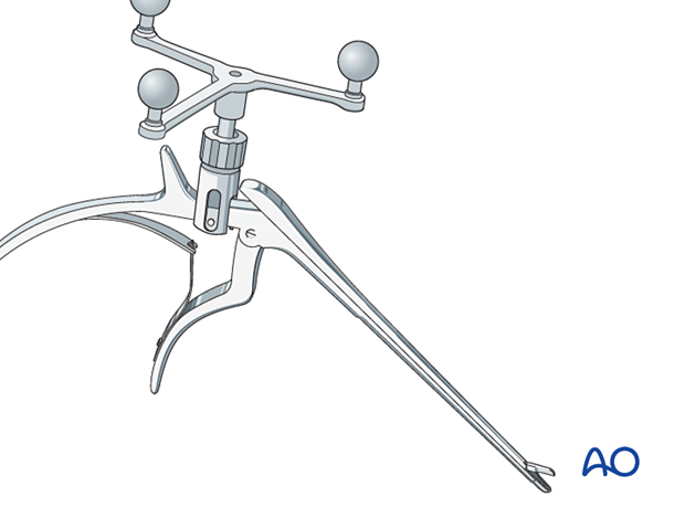 Most surgical instruments can be registered by attaching a DRF to them via a clamp