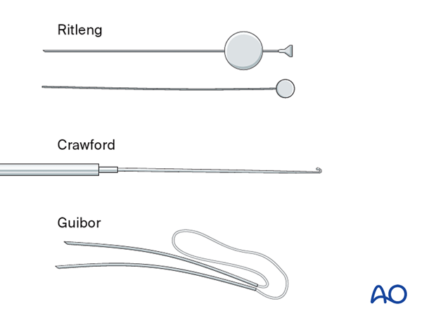Repair of periorbital soft-tissue injuries and lacrimal system in NOE injuries - full-thickness (bicanalicular intubation)