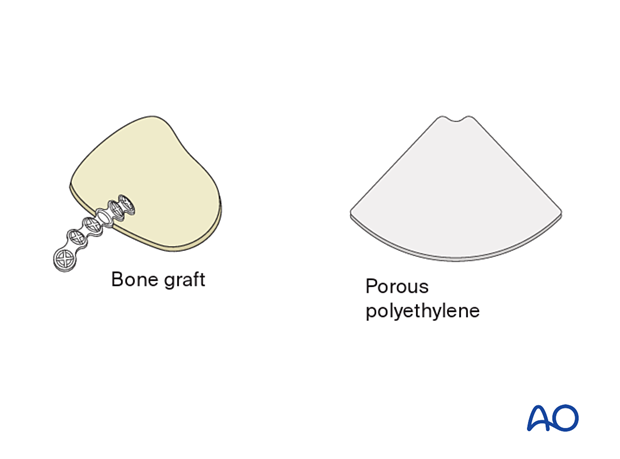 choice of implants – bone grafts and porous polyethylene implants