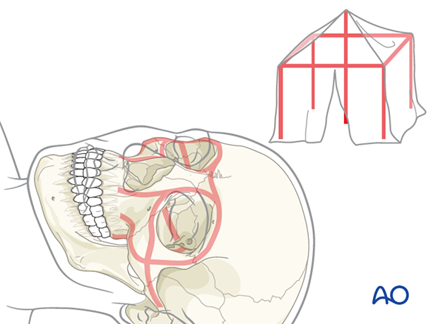 Midfacial injuries – Biomechanics of the midface 