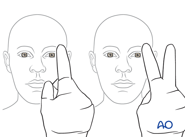 Examination of patients with midfacial injuries - visual acuity testing
