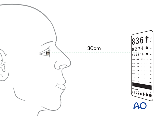 Examination of patients with midfacial injuries - Snell test