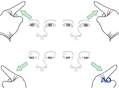 Examination of patients with midfacial injuries