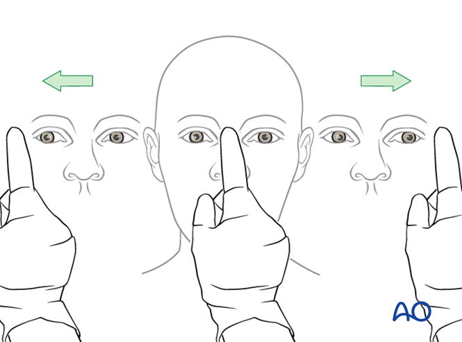 Examination of patients with midfacial injuries
