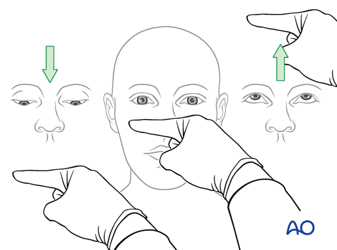 Examination of patients with midfacial injuries
