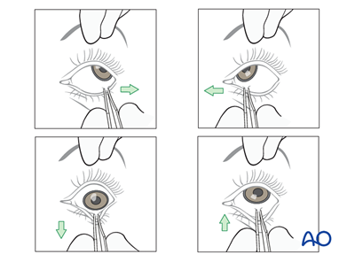 Examination of patients with midfacial injuries