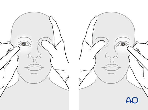examination of patients with midfacial injuries - pupillary reaction