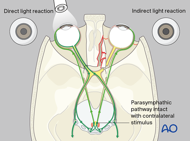 92 X070 Patient examination midfacial injuries