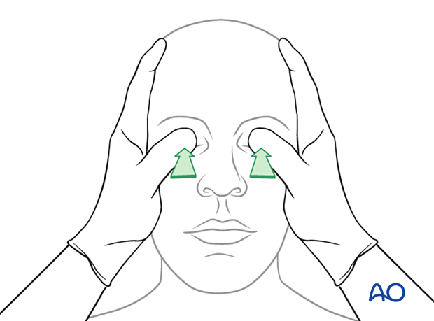 examination of patients with midfacial injuries - Gross digital intraocular pressure testing