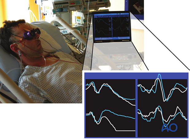 examination of patients with midfacial injuries - Visual evoked potential (VEP)