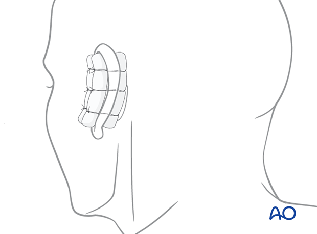 examination of patients with midfacial injuries – ear examination