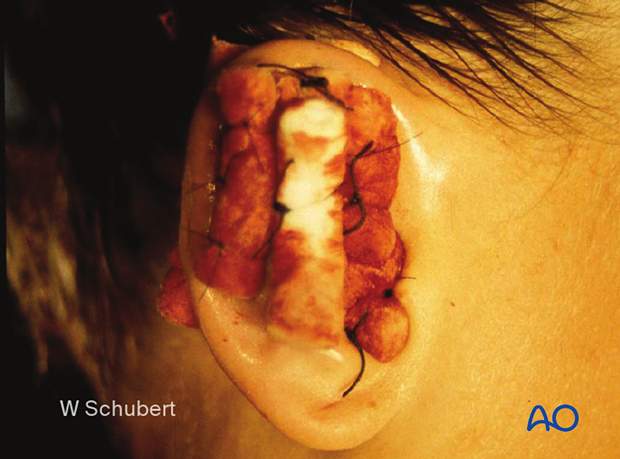 examination of patients with midfacial injuries – ear examination