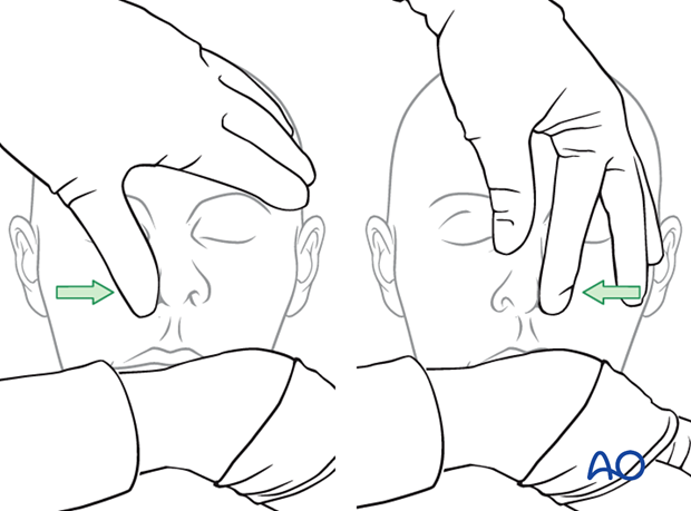 examination of patients with midfacial injuries – nasal examination