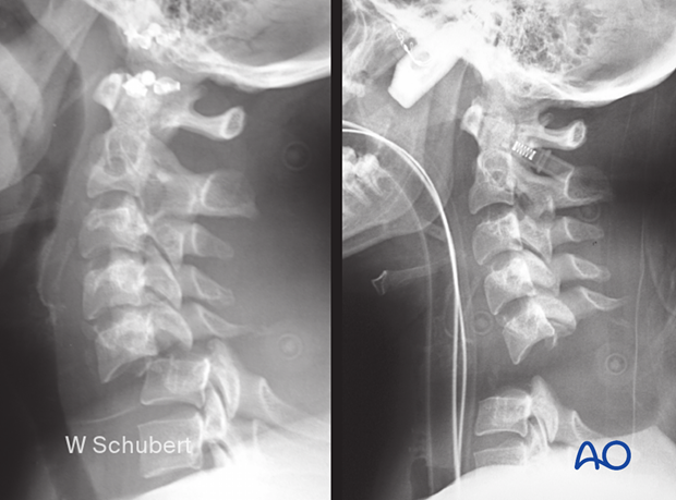 examination of patients with midfacial injuries – neck examination