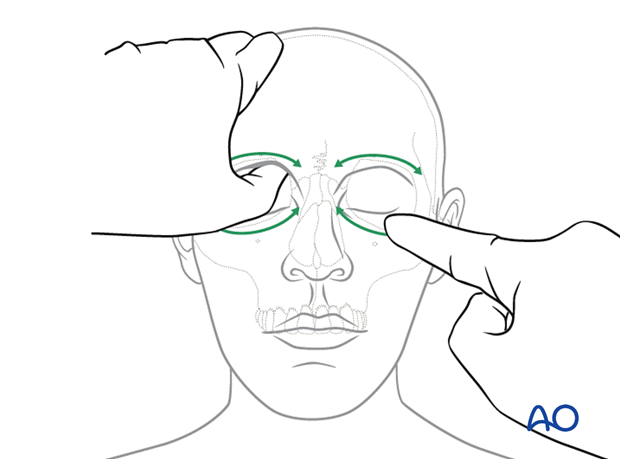 examination of patients with midfacial injuries – fracture palpation