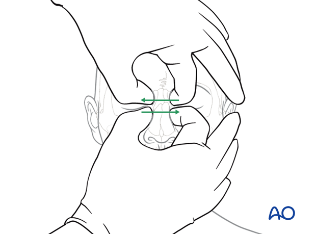 examination of patients with midfacial injuries – fracture palpation