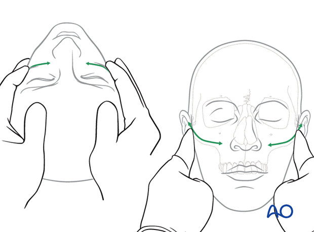 examination of patients with midfacial injuries – fracture palpation