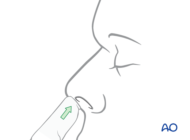 Examination of patients with NOE fractures - clinical examination