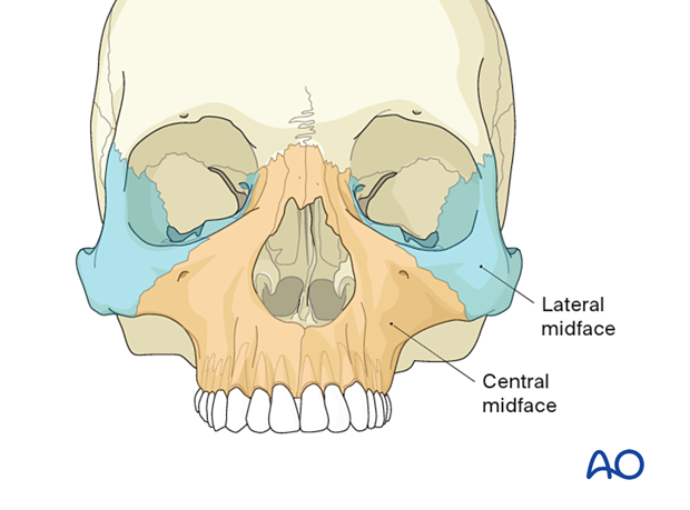 AO CMF Classification Midface Level 2 – CMF fracture location