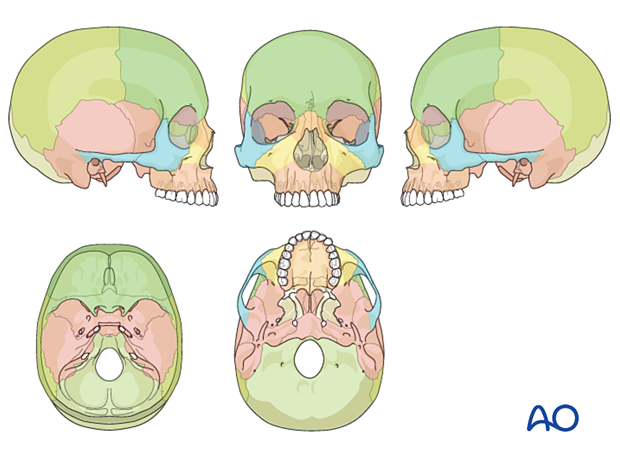AOCMF Classification Fractures of midface and orbit - Level 2 diagrammatic recording