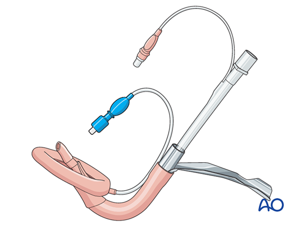 92 X130 Airway considerations