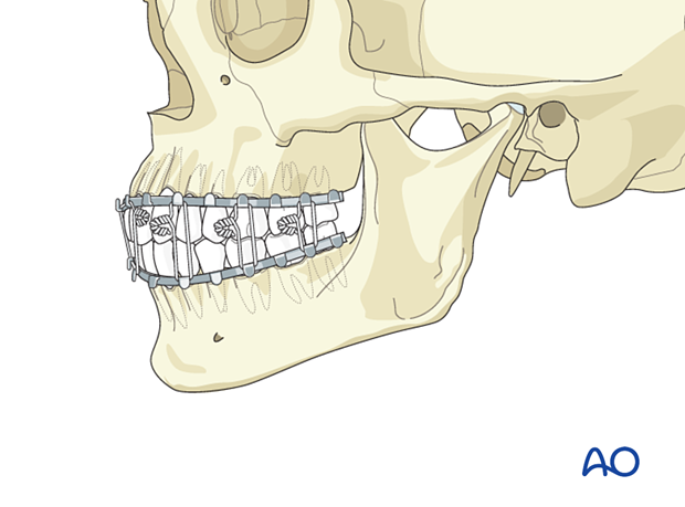 Airway considerations